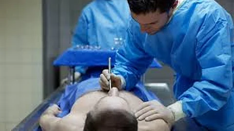 رجل يعود إلى الحياة بعد إعلان وفاته بنصف ساعة في إيطاليا