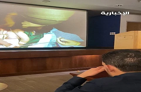 وسط دموع الأم وترقّب الأب.. انطلاق عملية فصل التوأم السيامي السوري "سيلين وإيلين" بالرياض