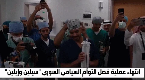 مشاهد مؤثرة بعد نجاح فصل التوأم السوري سيلين وإيلين ومغادرتهما غرفة العمليات