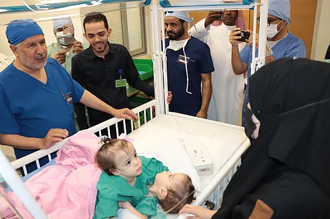 بعد قليل.. انطلاق عملية فصل التوأم السيامي السوري "سيلين وإيلين" بالرياض