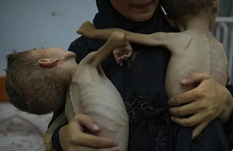 غزة أمام كارثة إنسانية غير مسبوقة.. أكثر من 1.2 مليون طفل يعانون انعدام أمن غذائي حاد