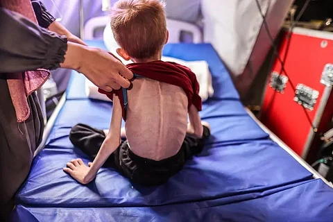 أطباء بلا حدود: واحد من كل 5 أطفال في غزة يعاني سوء تغذية