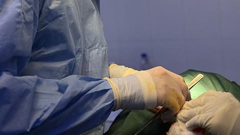 إنقاذ مريضة أربعينية من معاناة استمرت عامين بسبب المرارة