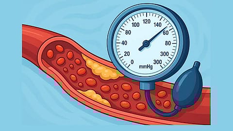 "النمر": دواء الكوليسترول ليس لكل مرضى الضغط.. وهذه الحالات التي تستدعيه