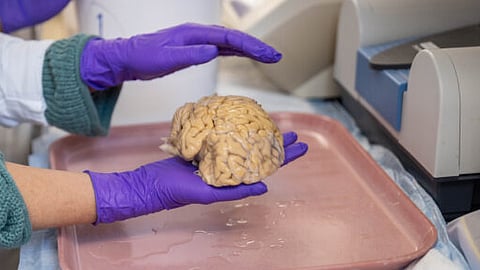 "المسنون الخارقون".. دراسة 25 عاما كشف كيف تتحدى أدمغتهم الشيخوخة وأمراضها