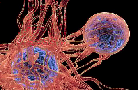 دراسة: فيروس شائع يندمج بالحمض النووي ويحفّز سرطان الجلد مباشرة