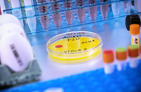 أول إصابة بشرية بسلالة H5N5 من إنفلونزا الطيور تُسجَّل في أمريكا