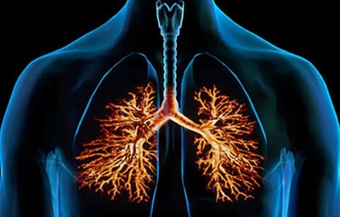 متاعب الشتاء والبرد.. كل ما يجب أن تعرفه عن التهاب الشُعَب الهوائية