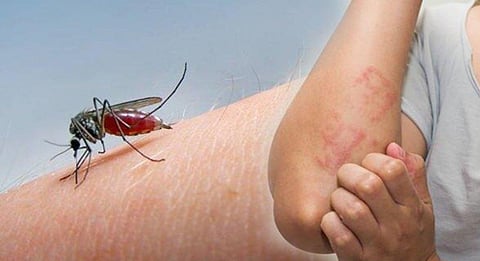 منها الملاريا وحمى الضنك.. دراسة تحذر: تغير المناخ ينذر بانفجار عالمي للأمراض المنقولة بالحشرات