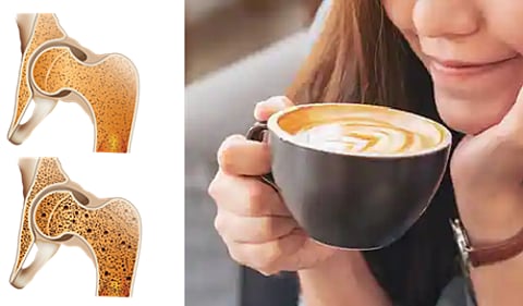 دراسة تحذر النساء: الإفراط في تناول القهوة يخفض كثافة العظام ويهدد بالهشاشة