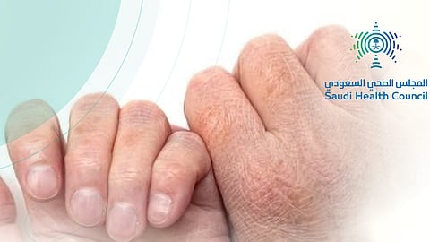 "الصحي السعودي" يُحذّر من علامات الجفاف في الشتاء لدى الكبار والصغار.. تعرّف عليها