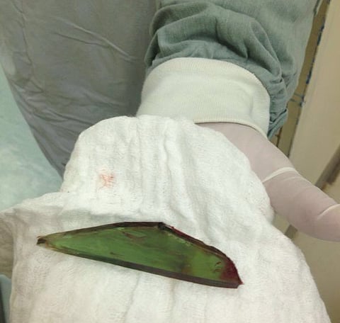 خطأ طبي يتسبَّب في تدهور صحة فتاة معاقة بمستشفى رماح