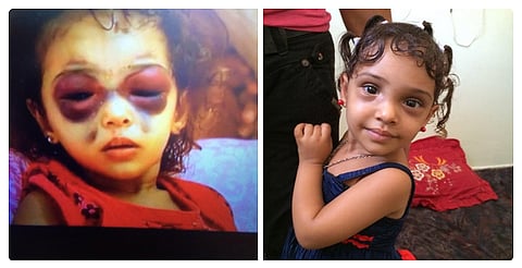 بالفيديو.. العثور على طفلة غزة "رمز العدوان" بصحة جيدة