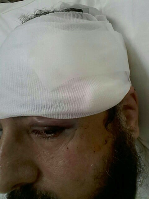 3 مجهولين يعتدون على عضو "هيئة" ويُصِيبونه في الرياض