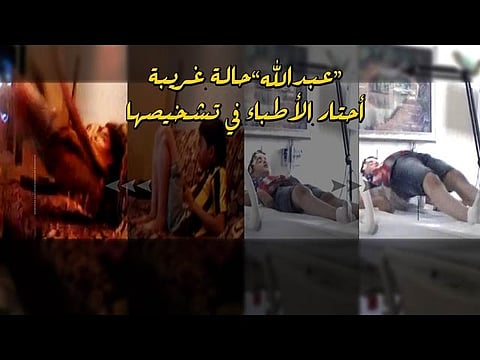 "فهد الطبية" تنجح في تخليص طفل من "رعشة الأعصاب"