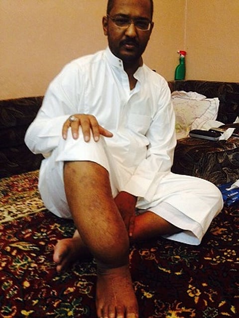 "الصحة": سنوفر العلاج لـ "السفياني" بمدينة الملك سعود الطبية