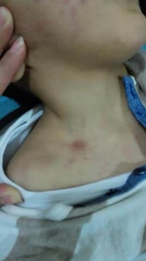 التحقيق في تعذيب طفل معاق خلال جلسات علاجية بالقطاع الخاص