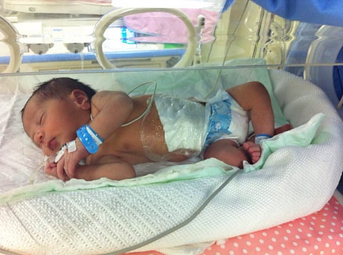 إنقاذ مولود يعاني من بزوغ بالكبد في الجوف