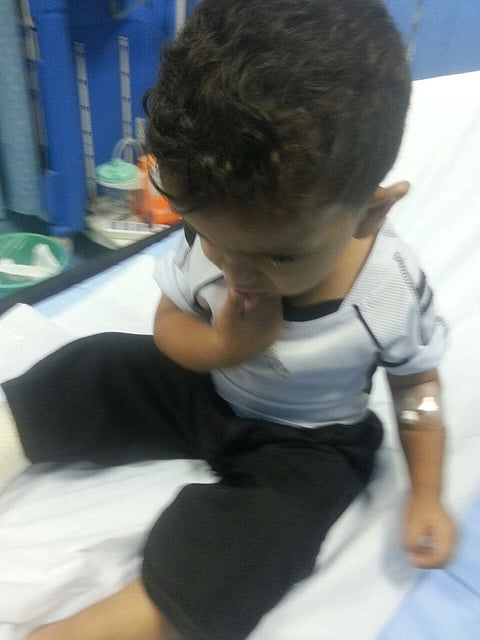 بيش.. تضارب في تشخيص حالة طفل ينتهي بتورم بعد تجبير لمرتين