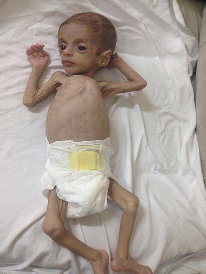 مرض غامض يمتص جسد الطفلة ميار ووالدها يناشد علاجها