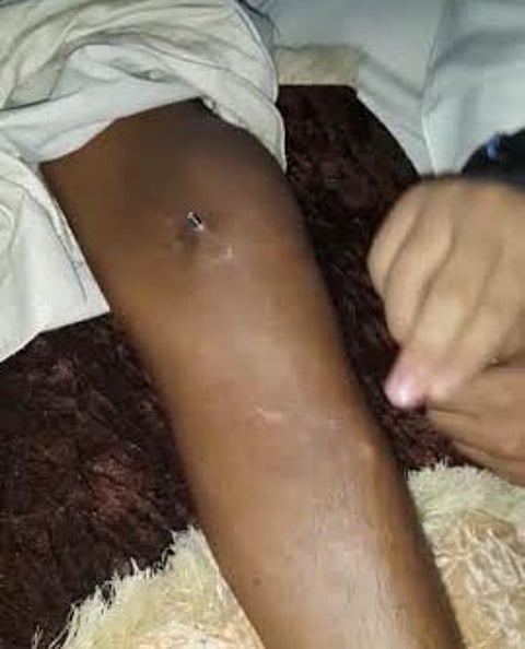 "صحة القصيم" تستدعي مواطنًا ظهر في فيديو يشتكي إهمالهم