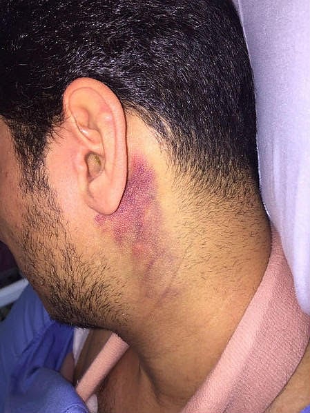 واقعة الفتيات والموسيقى تتفاعل .. "شرطة الشرقية" تُطيح بصاعقي رب الأسرة