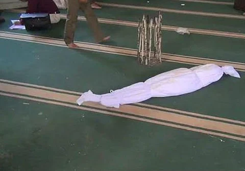 شاهد .. الطفلة التي قنصها الحوثيون في الرأس وأبكت الشعب اليمني