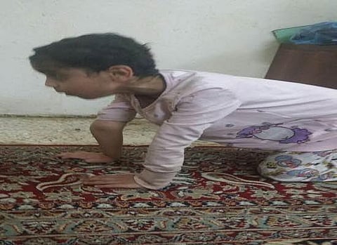 ذوو طفلة معاقة يناشدون قبولها بأحد مراكز التأهيل