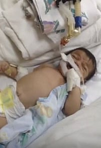 بعد "فيديو المولود الباكي".. متعب بن عبدالله يوجه بسرعة علاجه