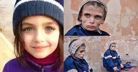 شاهد.. "مضايا السورية" حصار وموت جوعاً برعاية بشار و"نصر الله"