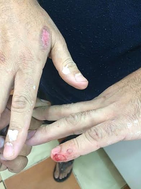 جولة بمطاعم حلي.. أطعمة ملوثة بالدماء وأعراض مَرَضية على أيدي العمالة