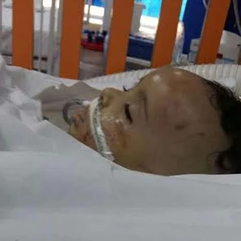 الطفل ضحية حقنة العارضة يفارق الحياة و"الصحة" تقف متفرجة