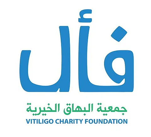 "فأل" تعالج أكثر من 300 مصاب بالبهاق خلال عام