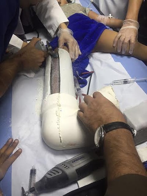 شاهد.. "مدني الخبر" يفكّ احتجاز قدم طفل من أنبوب مرحاض