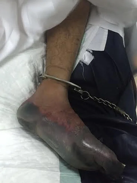 "الصحة" عن السجين المنوم بمستشفى صبيا: تدهور حالته استدعت تنويمه حال وصوله