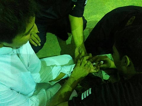 مدني جبة بحائل يحرر إصبع شاب من حلق حديدية