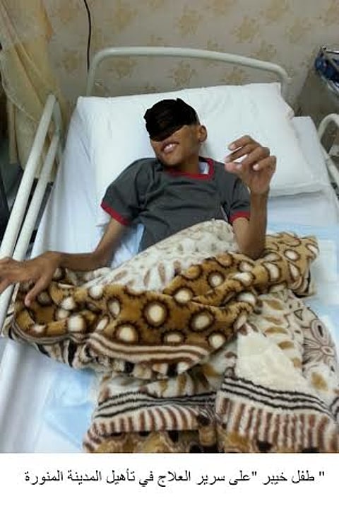 "الغامدي": لـ "سبق": طفل خيبر وشقيقتاه يتلقون العلاج ولم نسلمهم لأحد