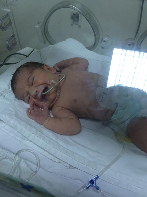 "مسك السورية".. رضيعة أنهكها قلبها الصغير وأمل والديها مستشفى متقدم