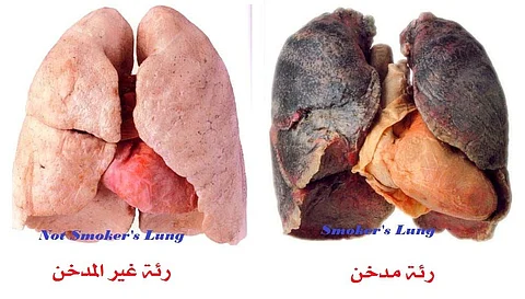 دراسة: تدخين علبة سجائر يومياً يسبب 150 تغيرًا ضارًا في الرئة