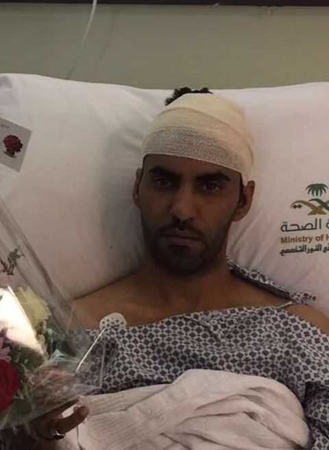 مكة.. مركبة متهورة تتسبب في إصابات خطيرة لرجل أمن
