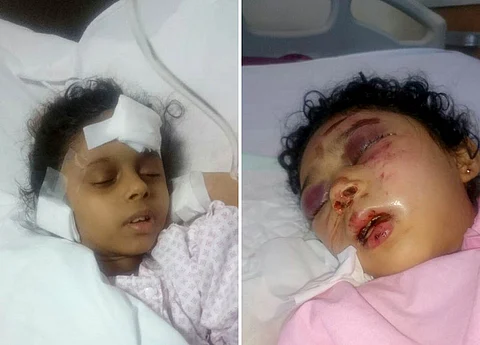 "سبق" تكشف قصة العاملة الأثيوبية بجازان.. ضربت الطفلتين بالحطب أثناء نومهما