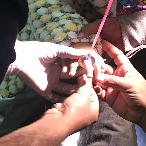"مدني العلا" يحرر قطعة معدنية من يد طفلة
