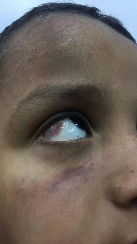 "التنمية الاجتماعية" تحقق في اتهام مواطنة لزوجها بالاعتداء على طفلها في بيشة