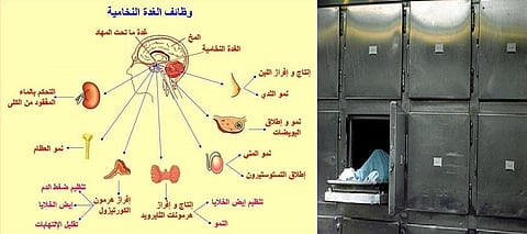 مصري يعود للحياة أثناء تغسيله.. وذووه يبحثون عن الطبيب الذي أعلن وفاته
