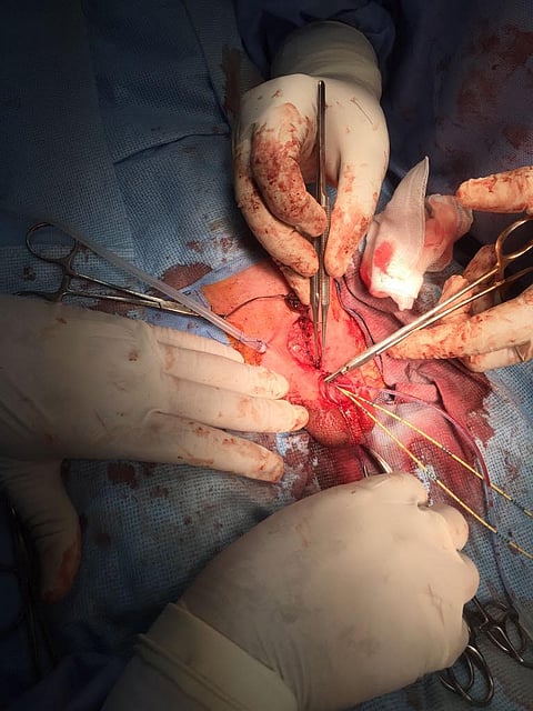 تدخل جراحي عاجل.. إصلاح تشوه خلقي لطفل عمره 4 أيام بالقطيف