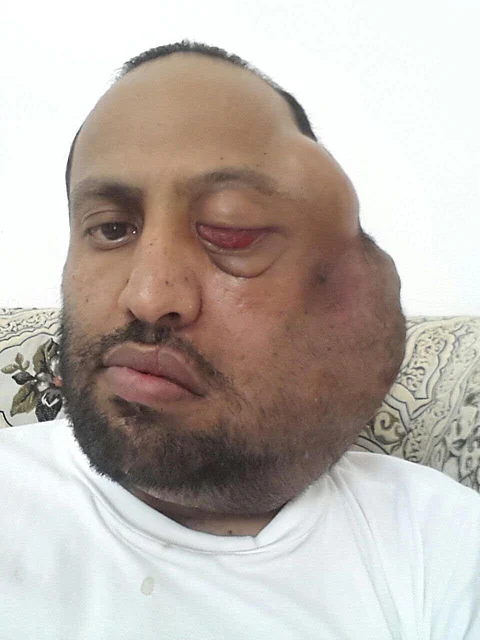 بأمر الملك .. "العصيمي" يتلقى العلاج بأرقى المستشفيات بألمانيا