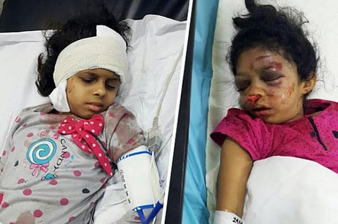 القضاء ينتصر لـ"رغد ورؤى".. الحُكْم 14 عامًا سجنًا للخادمة المعتدية عليهما بوحشية بجازان
