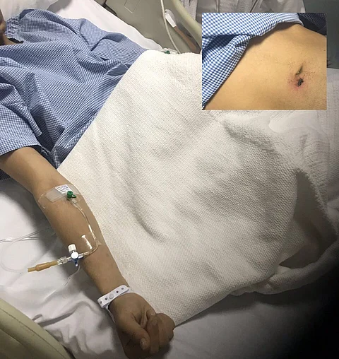 شجارٌ لفظي وطلقات نارية تُصيب "الفيفي" الجالس عند منزله بـ"سحيلي الطائف"