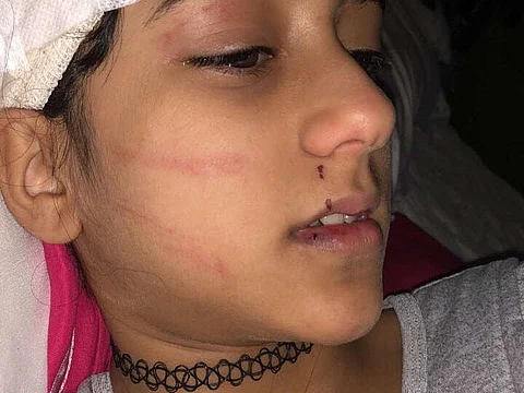 مايا بخش طفلة السوشيال ميديا تنجو من نمر في مزرعة شمال جدة