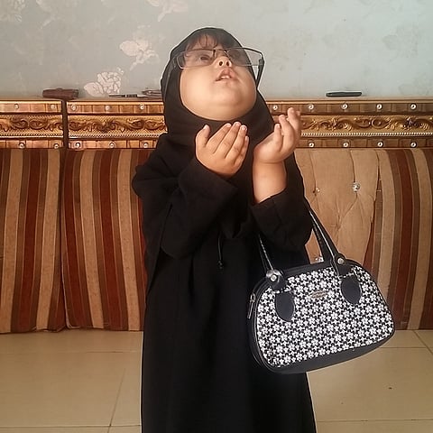 شاهد.. سكر الكبد ينفخ بطن "هدى".. ووالدتها تناشد علاجها بـ"فيصل التخصصي"